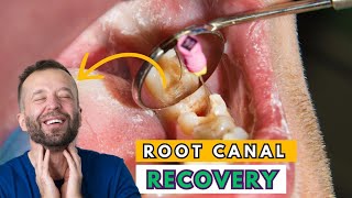 5 Root Canal Recovery Tips To Heal FAST! ( home remedy)