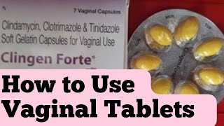 Vaginal tablets kese use krte h| How to use Vaginal Tablets screenshot 2
