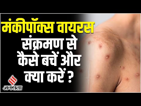 Monkeypox Virus से बचने के लिए क्या करें और क्या न करें !