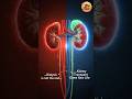 From Dialysis to New Life | Kidney Transplant Explained in 3D