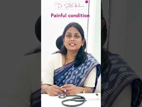Symptoms of Endometriosis