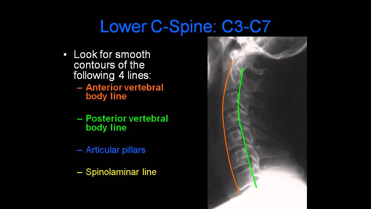 C Spine Radiology