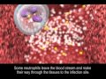 Immune response to bacteria