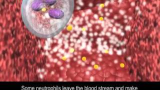 Immune Response to Bacteria