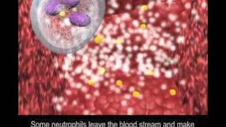 Immune Response to Bacteria