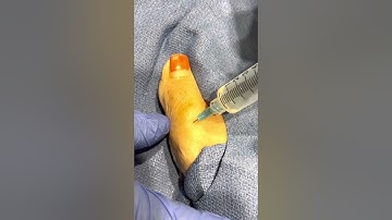 Digital toe block