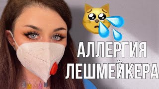 АЛЛЕРГИЯ ЛЕШМЕЙКЕРА. ВСЯ ПРАВДА + как защитить себя