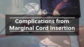 Marginal Umbilical Cord Insertion