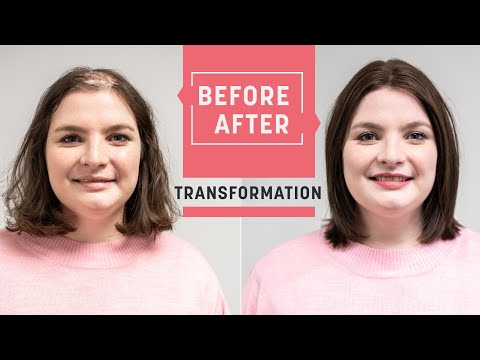 a-real-hair-topper-for-new-confidence-|-help-with-alopecia-areata-|-hairsystems-heydecke