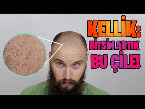 Kellik: Bitsin Artık Bu Çile!