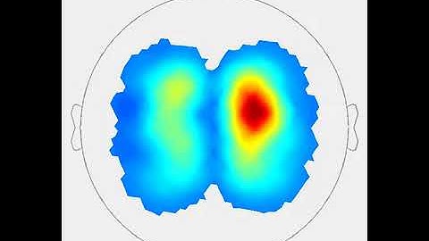 NIRx   nirsLAB analysis software   oxy hemoglobin dynamic visualization