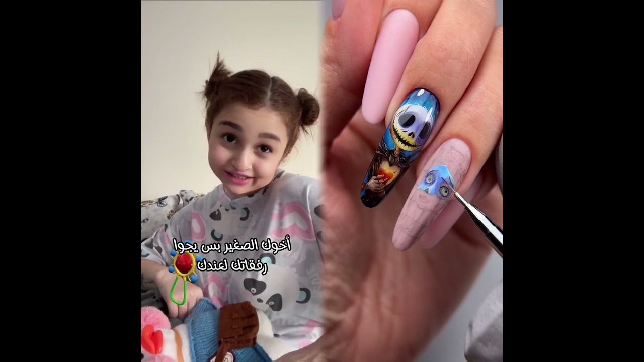 #الطفل الاعمى المعجزه #محضوره_من_الاكسبلور_والمشاهدات #علاوي_مارتن #اكسبلور 15_w