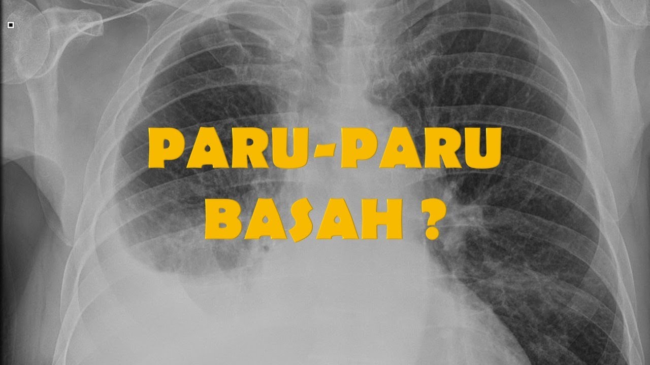 APA ITU PARU-PARU BASAH? 