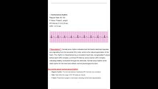 Relias Dysrhythmia Basic A Assessment Test Latest 2025 2026 Most Comprehensive to Pass the Exam, 1