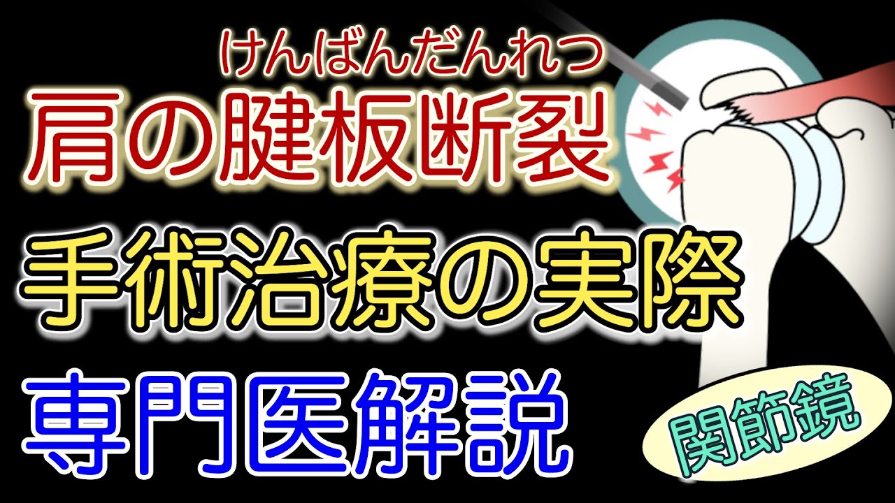 【専門医解説】肩の腱板断裂　手術の実際