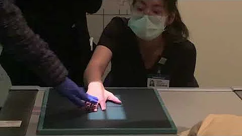 PA: Fingers