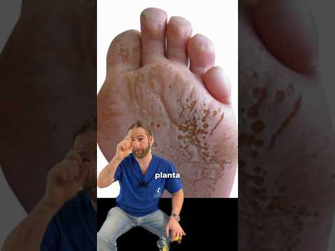 Si te sale ESTO en los pies, mira este vídeo