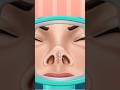 asmr nose surgery #shorts #youtubeshorts #asmr