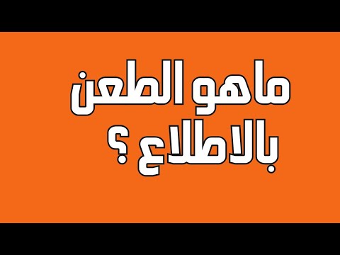 طعن الضرائب بالاطلاع على الملف