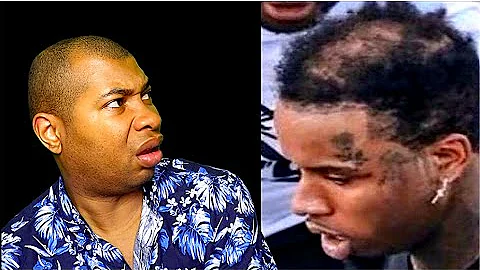 Tory Lanez From Hair Loss To Court Loss: An Open F...