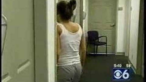 Botox tx for sweating (Hyperhidrosis)-Williams Ctr