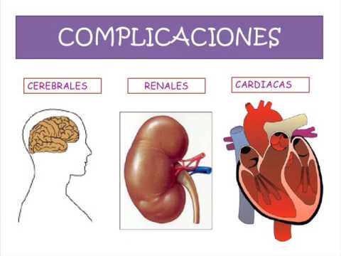 Prácticas para k es la hipertensión