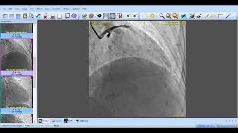 Sante DICOM Viewer 10 29 2018 8 50 07 PM
