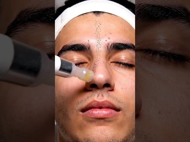 That soft pop at the end… pure ASMR therapy 🎧💆‍♀️