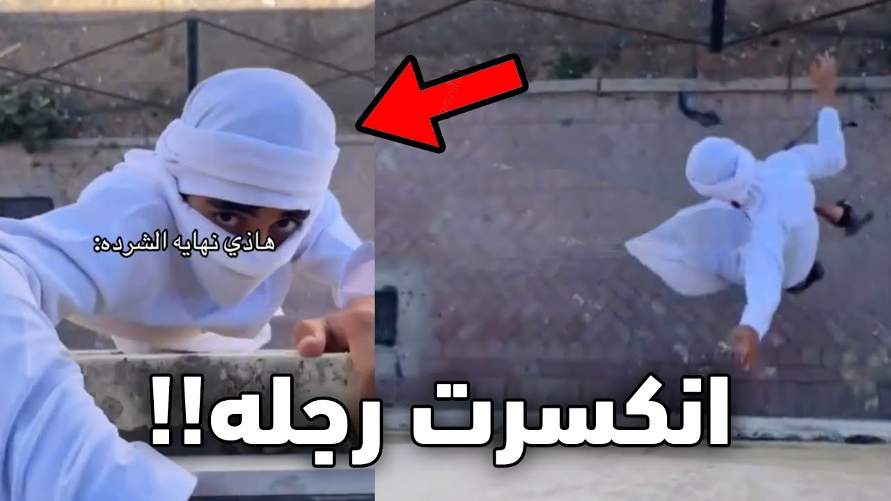 الولد هذا طاح من الدور الثاني وانكسرت رجله!