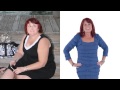 Lap Band Success Stories - SmartShape