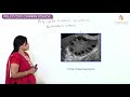 Polycystic ovary syndrome (PCOS) Part-1 - OBG / GYNE for Fmge and Neet pg by Dr Ramya sree