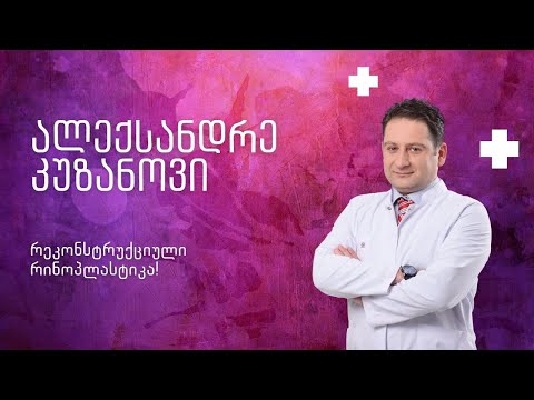 ჩავატარე მეორადი რეკონსტრუქციული რინოპლასტიკა!