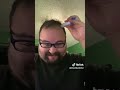day 62 of restoring my hairline