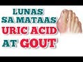 Lunas sa Mataas ang Uric Acid at Gout - Payo ni Doc Willie Ong #57