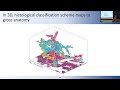 3D reconstruction of human pancreatic precancers reveals novel microanatomical phenotypes