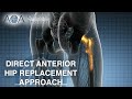 AOA Orthopedic Specialists - Direct Anterior Hip Replacement Approach