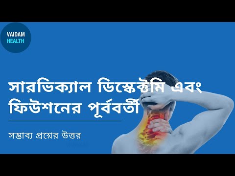 পূর্ববর্তী সারভিক্যাল ডিসেক্টমি ফিউশন - প্রায়শই জিজ্ঞাসিত প্রশ্ন