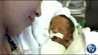 Miracle Baby Declared Dead But Later Found Alive in Morgue Turns One Month Old1064