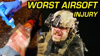 WORST AIRSOFT INJURY
