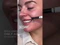 Does Rejuran Help Smile Lines?
