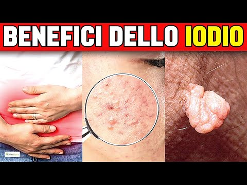 Video: 3 modi per aggiungere più iodio alla tua dieta