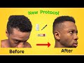New Hair Loss Prevention Protocol For men | Based on Science