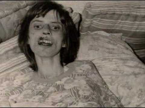 Anneliese Michel , the real Emily Rose