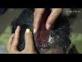 Natural Dandruff With Combing!! Dandruff Scratching Satisfying #284