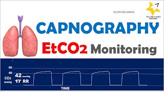 Capnography | ETCO2 Monitoring