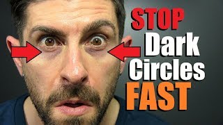 10 Tricks To FIX Dark Under Eye Circles FAST! screenshot 4