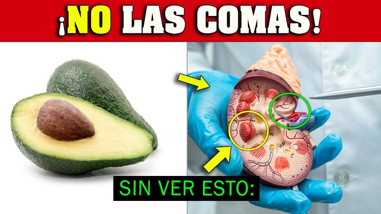 ¡ALERTA! quienes NO DEBERÍAN Comer AGUACATE 🥑 (Palta) ⛔