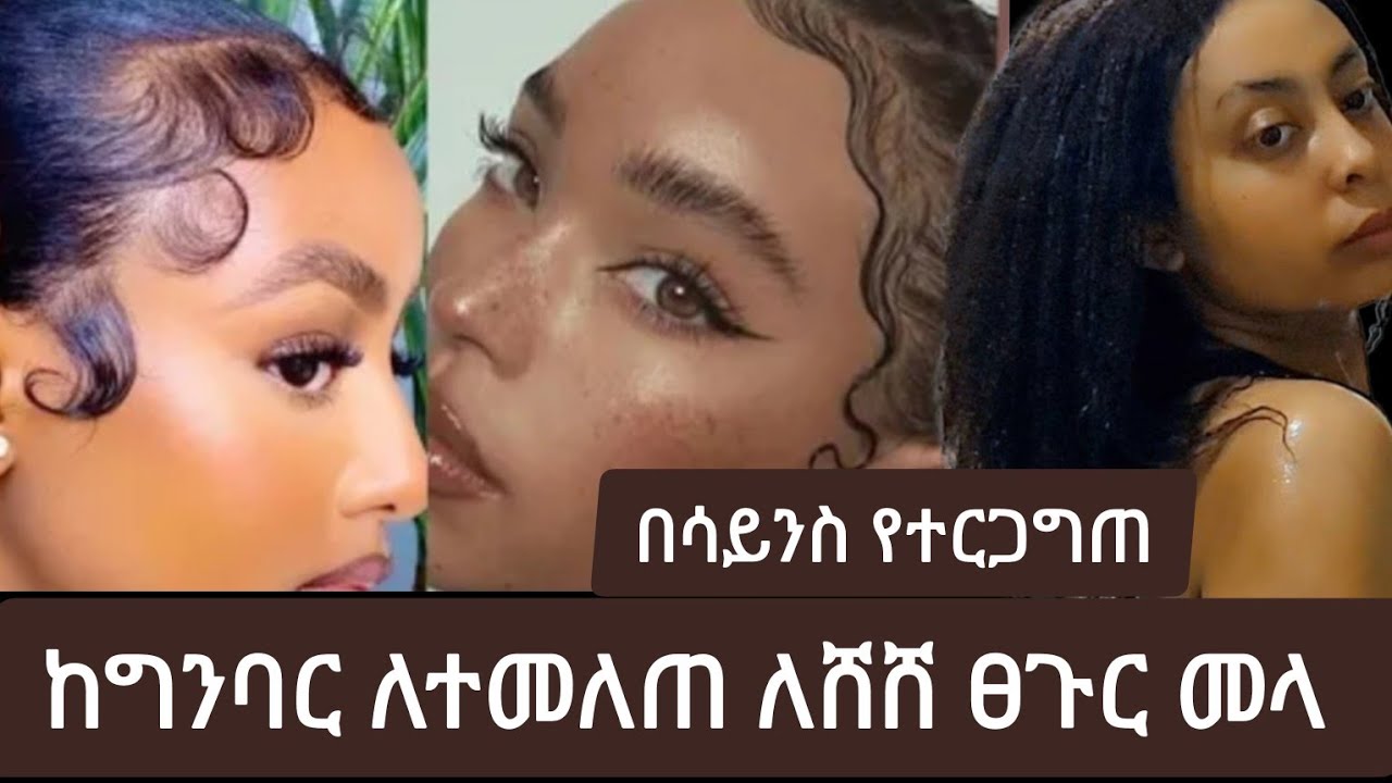 የግንባር ፀጉር | baby hair | ለማሳደግ ትክክለኛው መንገድ የፊት ለፍት ፀጉር ለማብቀል #Rosemary  how I grow baby hair #የጥብስቅጠል