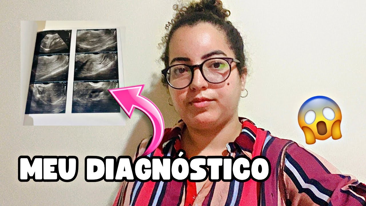 💥 DECIDI CONTAR A VERDADE SOBRE MINHA SAÚDE PARA VOCÊS! 