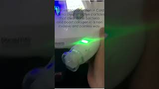 Cold Plasma Machine for Sale: Acne Removal, Skin Firming & Collagen Boost